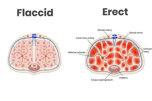 Flaccid and erection
